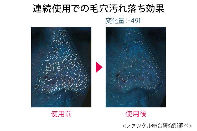 ファンケル酵素洗顔連続使用後の毛穴の汚れ落ち